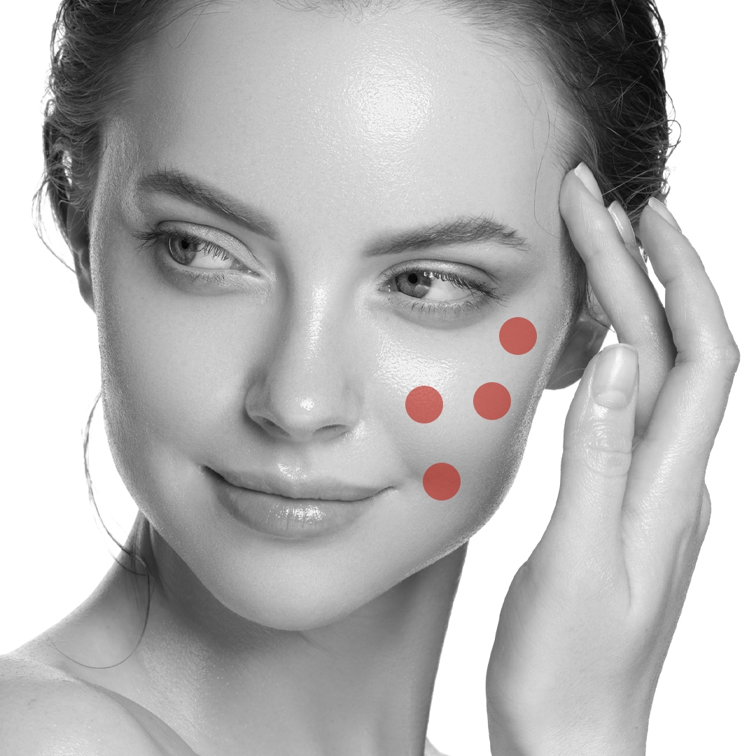 Biorevitalization Ejal 40 - rejuvenates and tightens facial skin