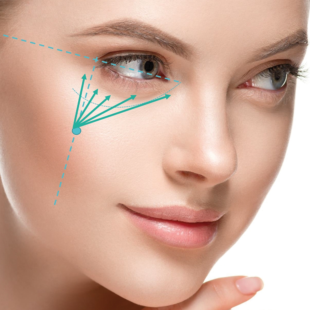 Nucleofill Soft Plus EYES - премахва бръчките и сенките около очите